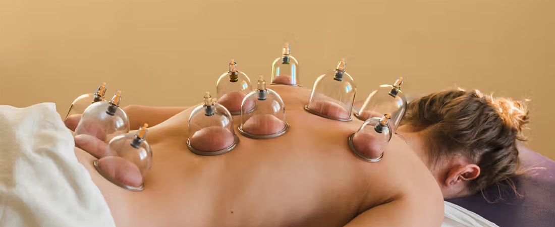 Dry Needling